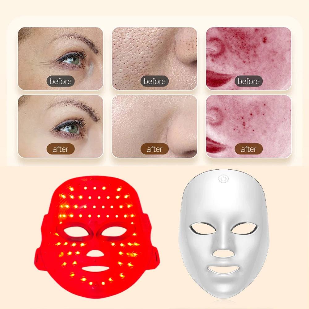 LED Light Therapy Mask — 7 Colours, Cordless